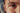 Understanding Oily Skin: The SBLA Perspective