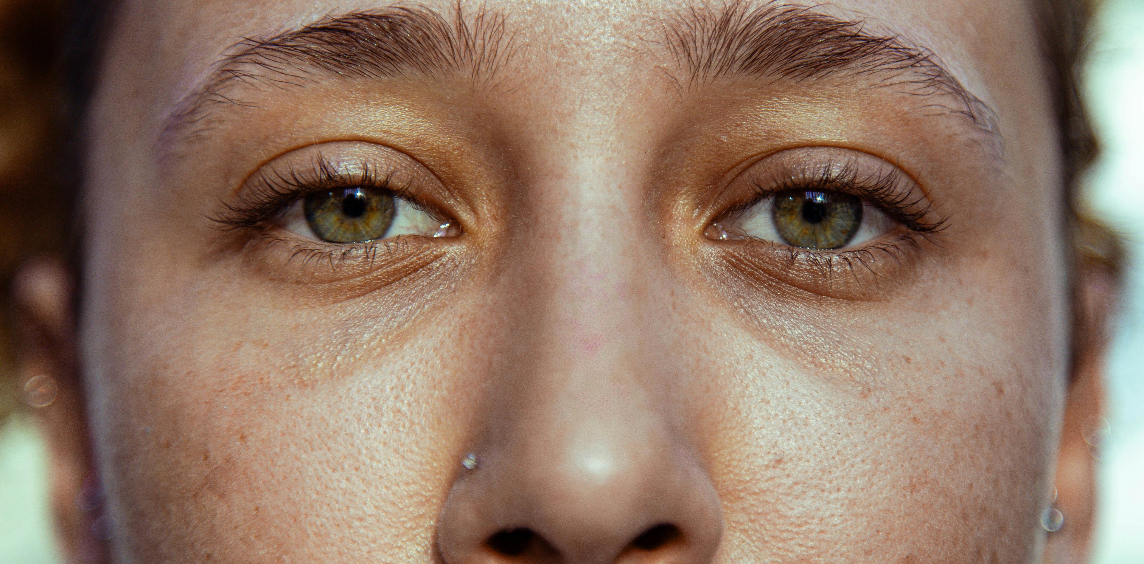 Large Pores? Here’s How SBLA’s Firming Tools Improve Texture Over Time