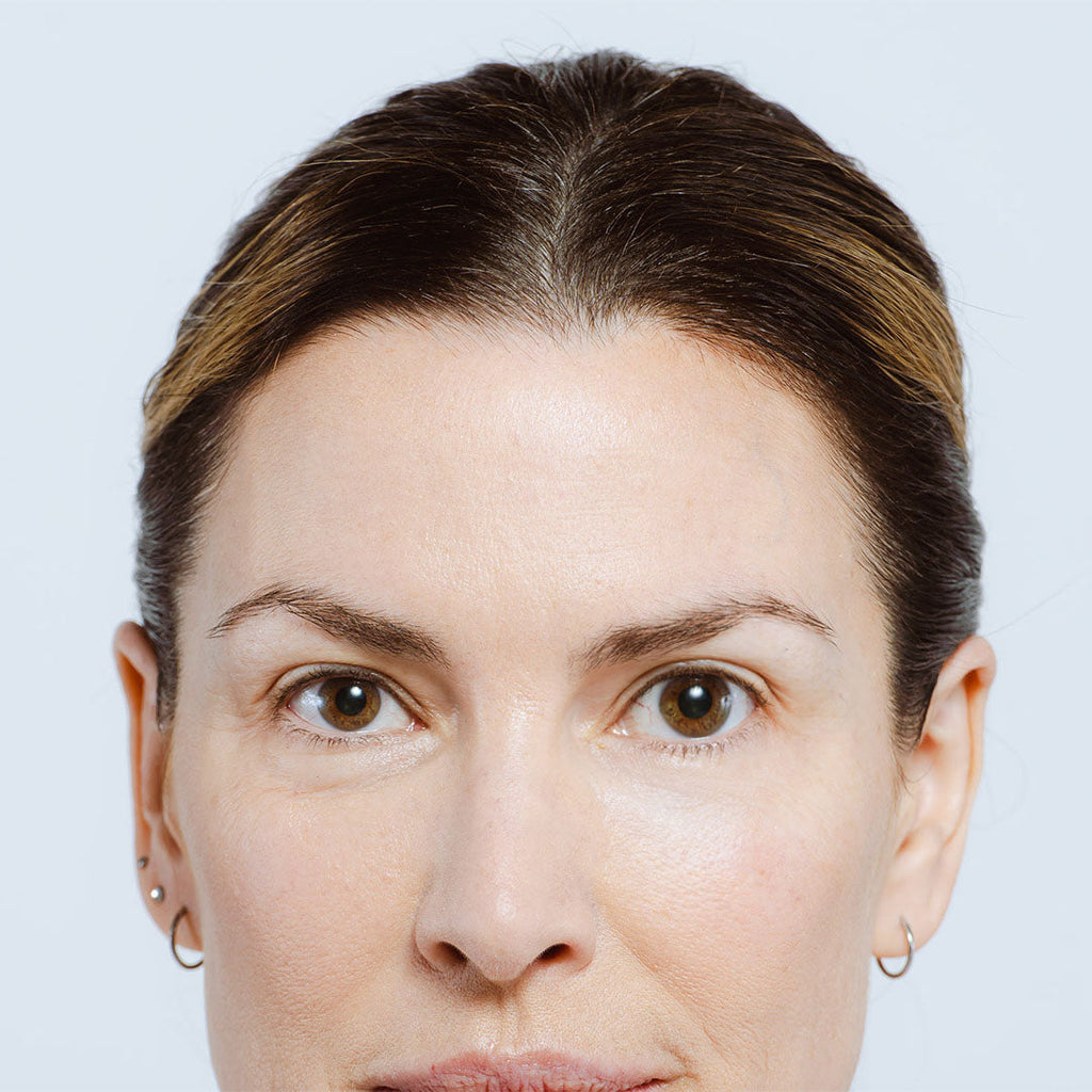 NuFace vs. Solawave for Lifting & Toning: An Expert Comparison