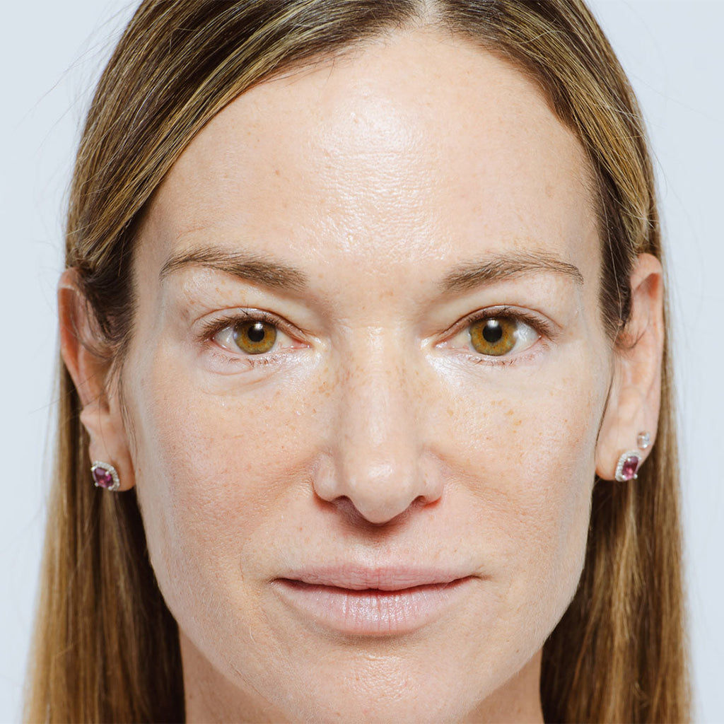 Which Devices Actually Help Define the Jawline: A Comprehensive Guide