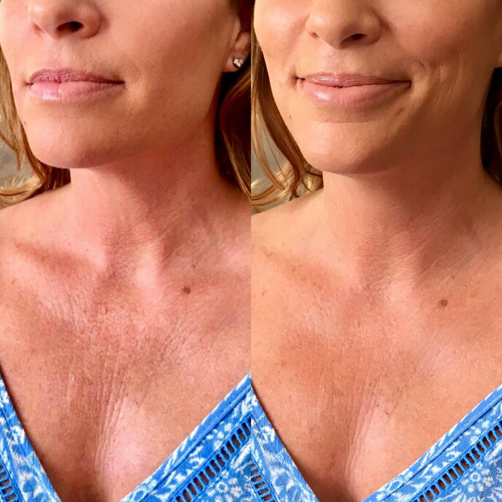 Best Serums for Tightening the Neck Area: Top Picks for Youthful Skin