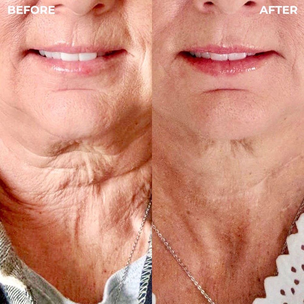 Top 10 Best Wrinkle Prevention Ingredients for Youthful Skin