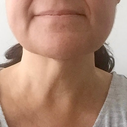 At-Home vs. In-Clinic Tightening Results: The Honest Truth (2026 Guide)