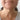 The Best Treatments for Forehead Lines: Achieve Smooth, Youthful Skin