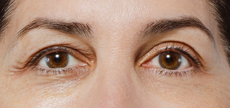 Is Retinol Enough to Stop Wrinkles? Evaluating Its True Effectiveness