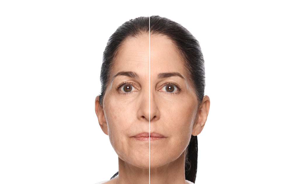 How Young Is Too Young to Treat Neck Wrinkles? Expert Insights Inside