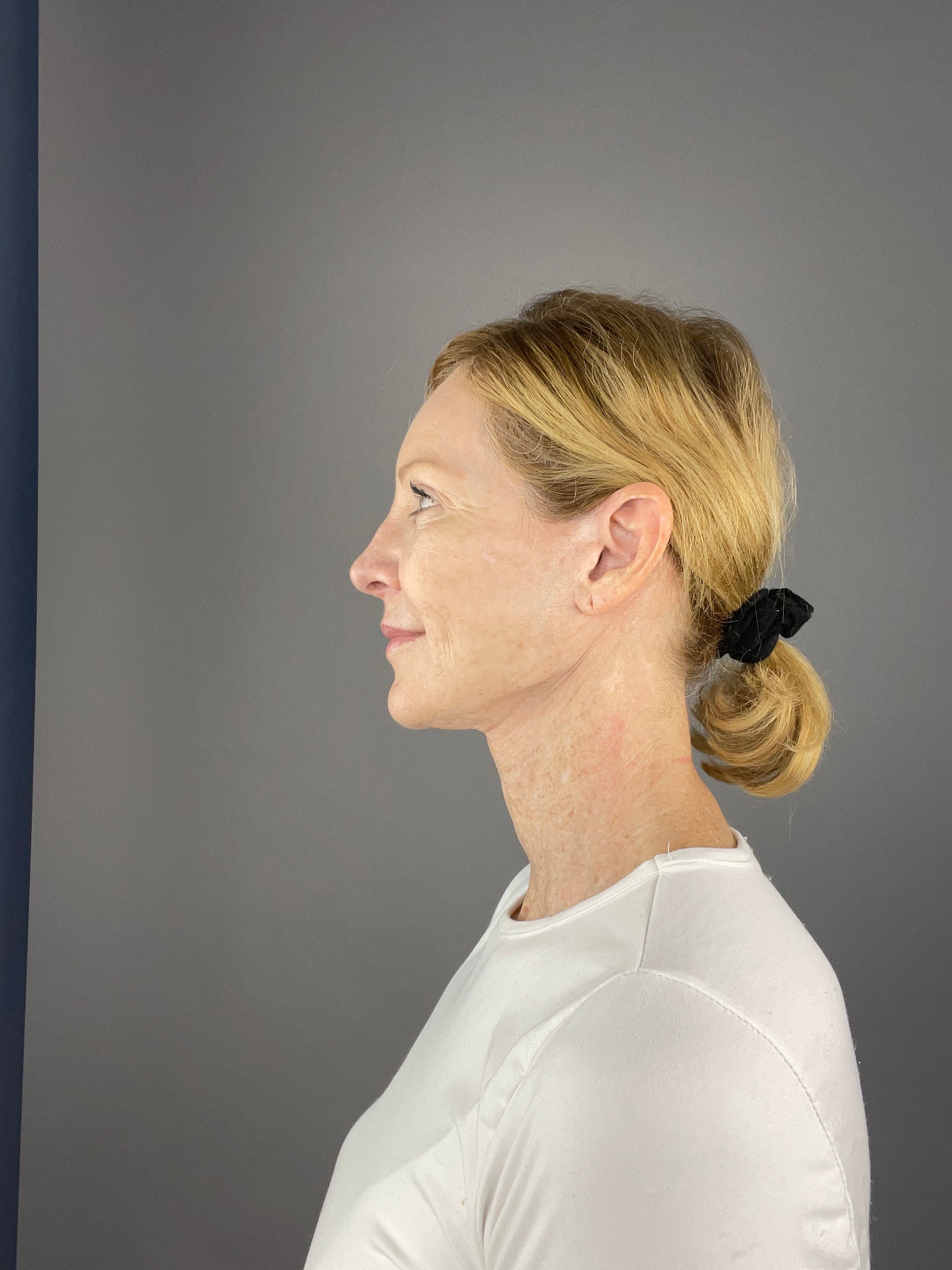 How Alcohol Affects Skin Aging: Tips for a Youthful Complexion