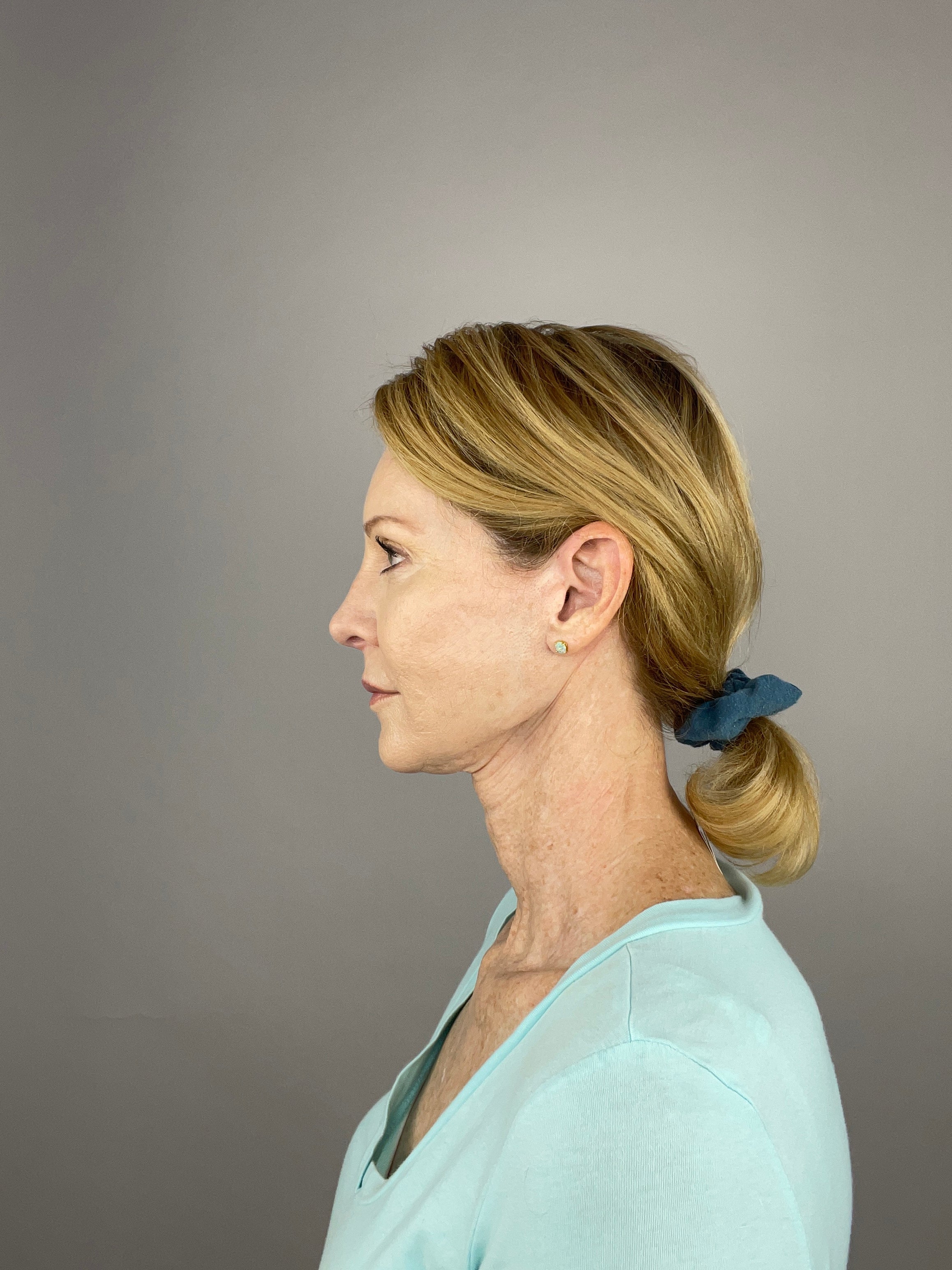 Daily Habits That Make Neck Aging Worse and How to Avoid Them