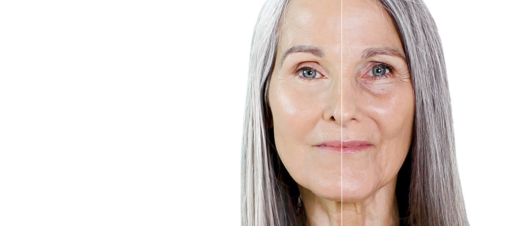 Can You Reverse Tech Neck Lines? Effective Solutions and Treatments