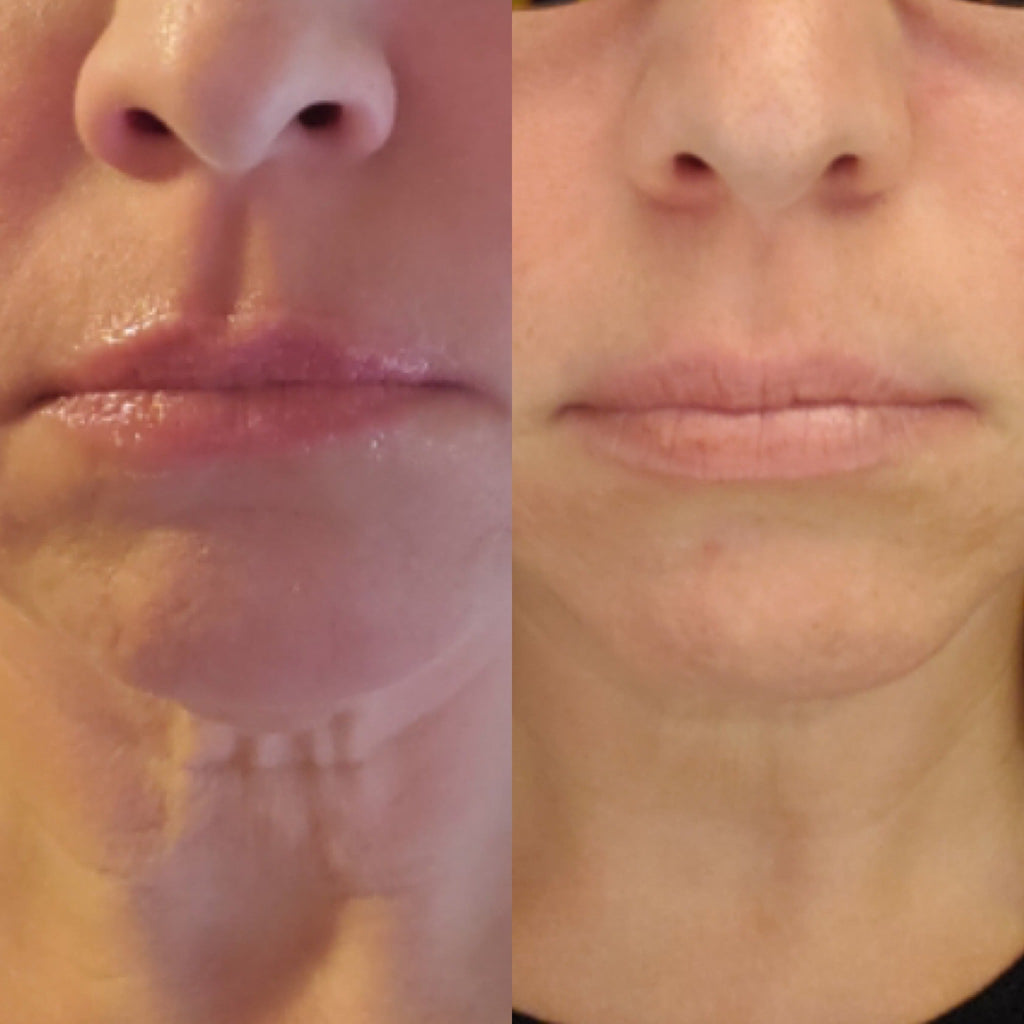 Comparing Popular Anti Aging Tools Pros Cons: A Detailed Analysis for Your Skin Care