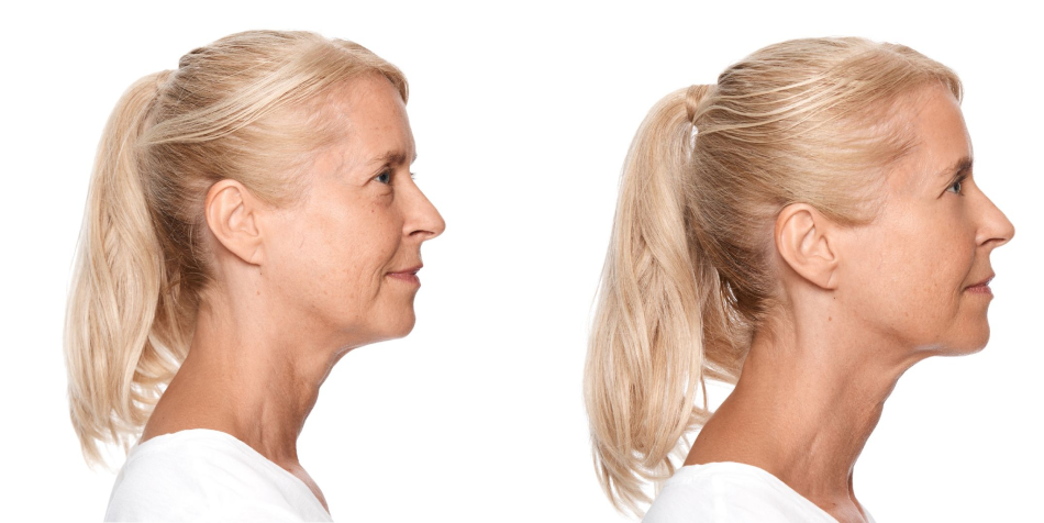 How At Home Skincare Tech Is Changing Beauty for Better Skin Results
