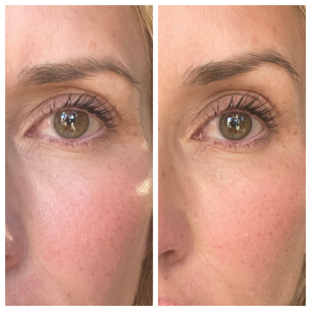 Device-Serum Combos Vs Device-Only Routines: A Practical SBLA Beauty Outline