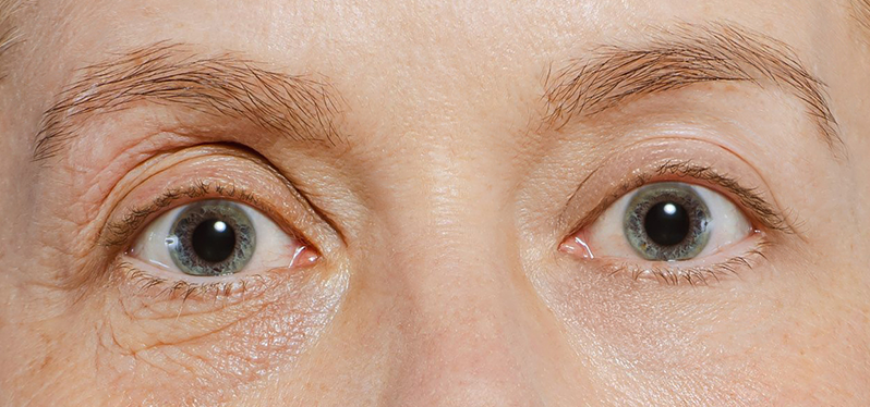 Why Some People Age Slower Genetically: The Key Factors Explained