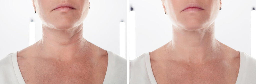 What to Avoid When Using Anti Aging Devices for Best Results