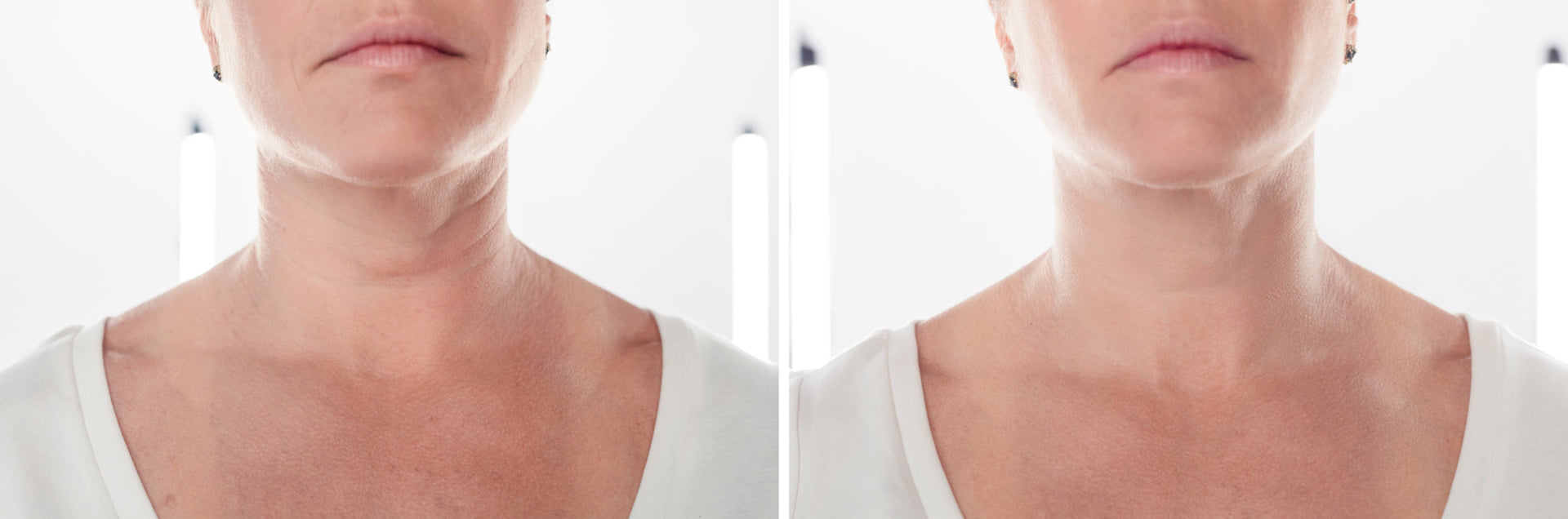 What to Avoid When Using Anti Aging Devices for Best Results