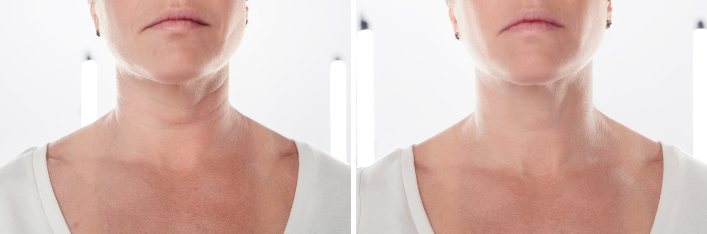 What to Avoid When Using Anti Aging Devices for Best Results