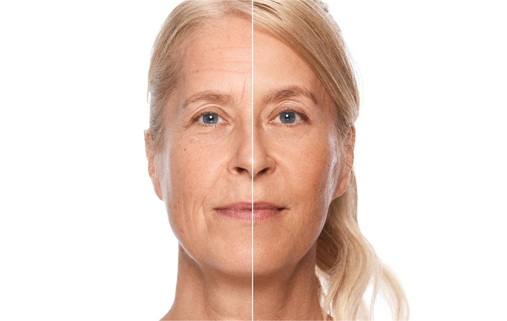 How Long Until You See Results from At Home Devices? A Realistic Guide