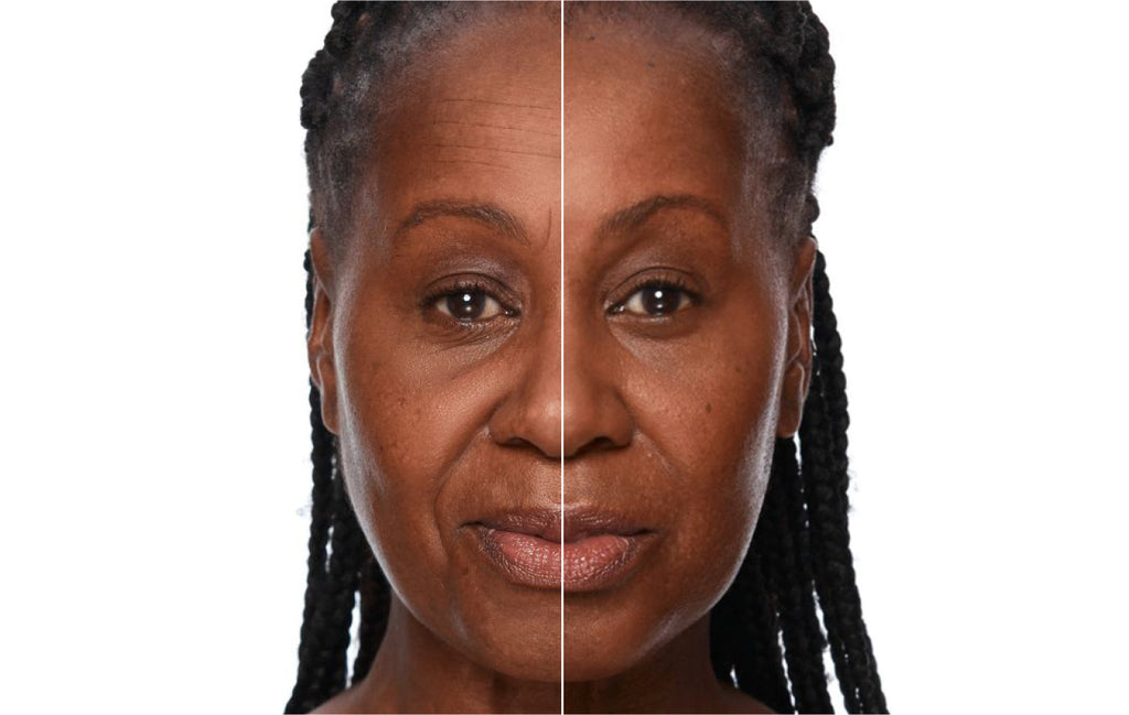 Microcurrent vs Radiofrequency: Differences & Benefits for Skincare