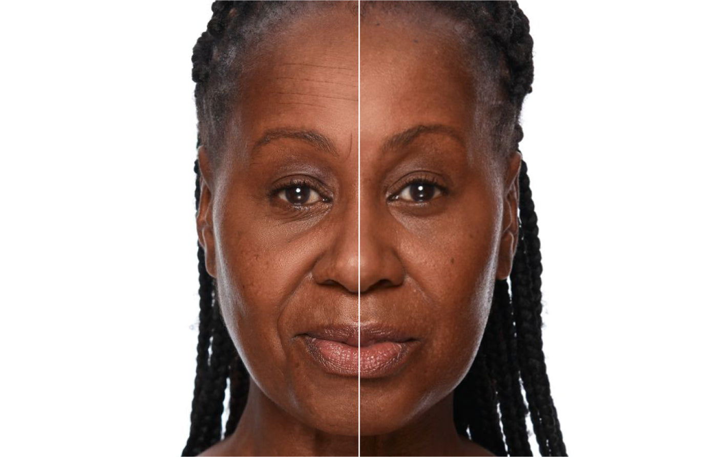 Microcurrent vs Radiofrequency: Differences & Benefits for Skincare