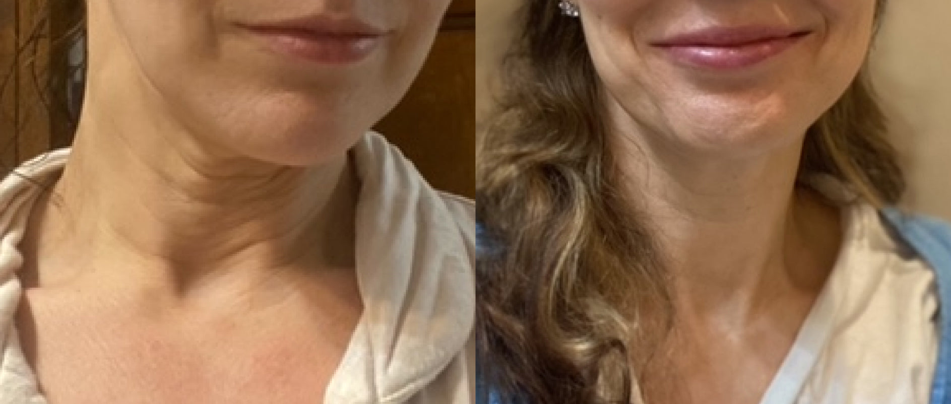 5 Wrinkle Myths Women Still Believe That Could Be Aging You Faster