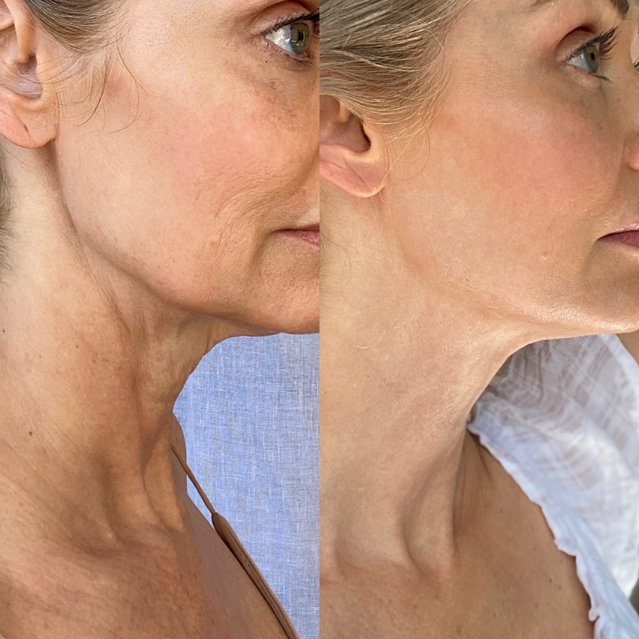 The Difference Between Dry Skin and Aging Skin: Key Insights for Care