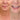 Why Crow’s Feet Appear Earlier Than Other Wrinkles