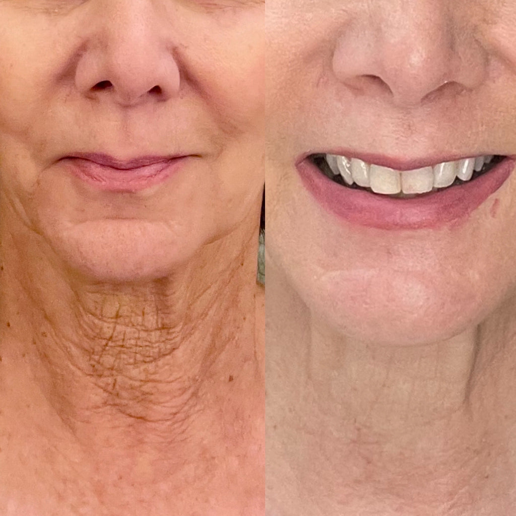 5 Wrinkle Myths Women Still Believe That Could Be Aging You Faster