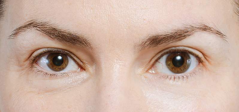 How Aging Changes Facial Structure: Understanding the Transformations