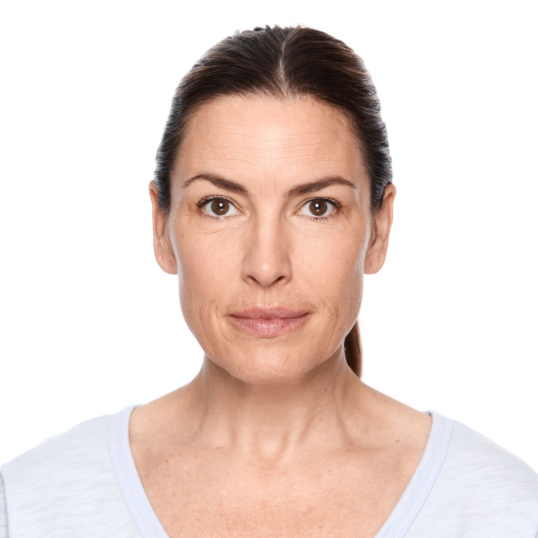 Are Facial Devices Safe for Menopausal Skin? A Dermatologist-Approved Guide