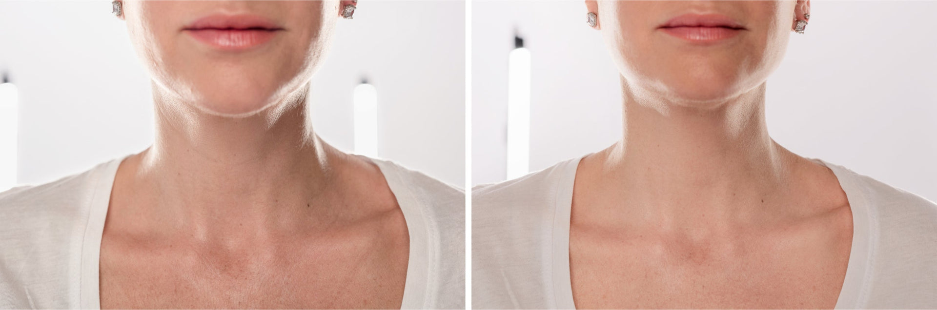 What Really Causes Sagging in the Neck After 40? (Loose Neck Skin & Neck Wrinkles Explained)