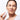 Nasolabial Folds Treatment at Home: The 2026 Clinical Guide to Lower Face Sculpting
