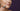 Retinol for Sagging Jowls: A Clinical Perspective on Non-Invasive Sculpting