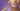 How to Get Rid of Marionette Lines Naturally: The 2026 Clinical Guide