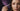 How to Lift Hooded Eyes Without Surgery: The 2026 Clinical Guide