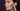 How to Reduce Nasolabial Folds Without Fillers: The 2026 Clinical Guide