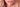 How to Use a Lip Sculpting Tool for Clinical Results: The 2026 Guide