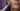 Non-Surgical Chin Sculpting: The 2026 Guide to Non-Invasive Contouring
