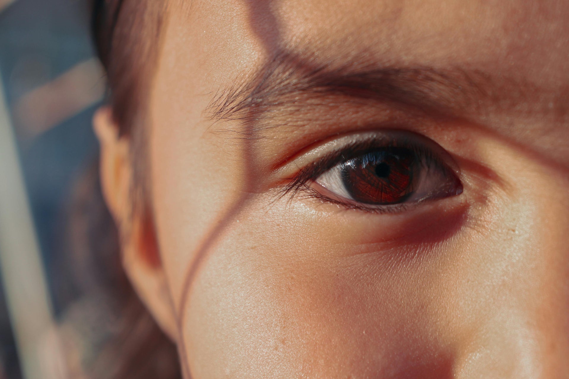 Understanding Oily Skin: The SBLA Perspective