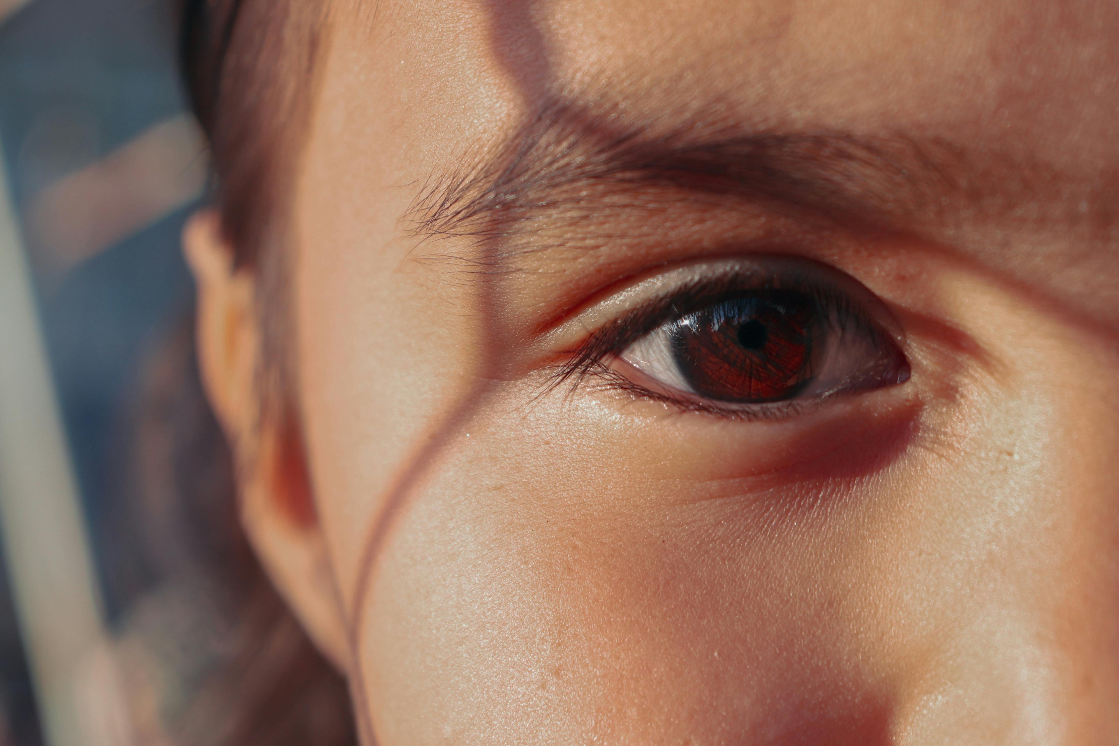 Understanding Oily Skin: The SBLA Perspective