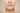 Marionette Lines Before and After: A Clinical Guide to Non-Invasive Lower Face Rejuvenation