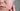 Smoothing the Surface: Addressing Rough and Bumpy Skin with SBLA