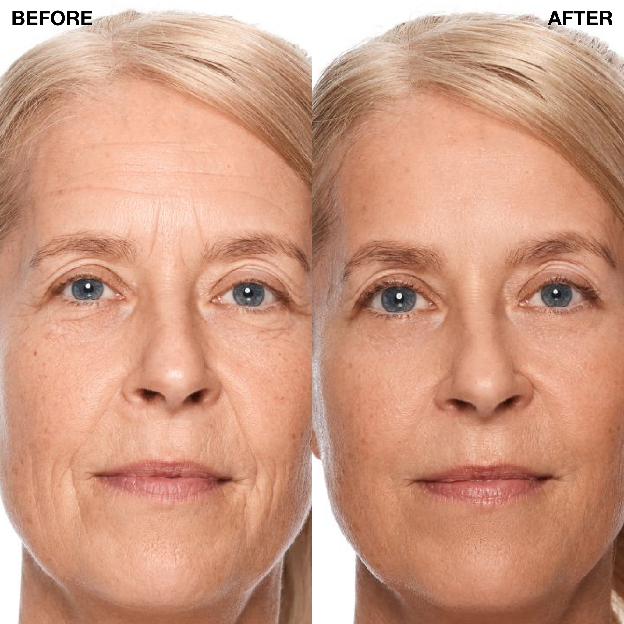 Model before after using Liquid Facelift Wand