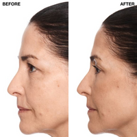 Model 2 before after - profile view
