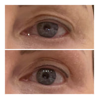 Close up of eye before after - Randi 55 yr old female