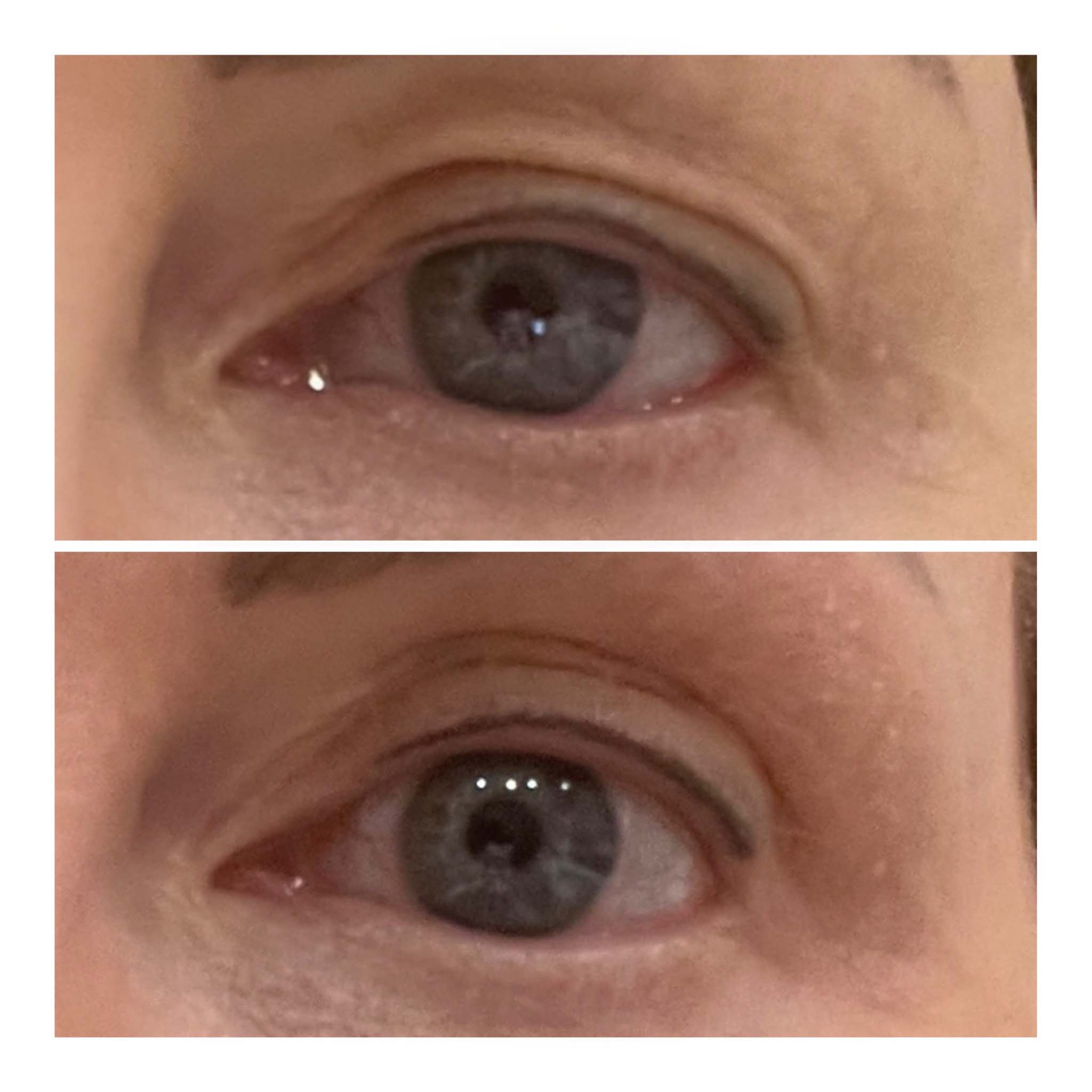 Close up of eye before after - Randi 55 yr old female