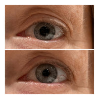 Close up of eye showing before after - Genevieve C. 54 yr old female