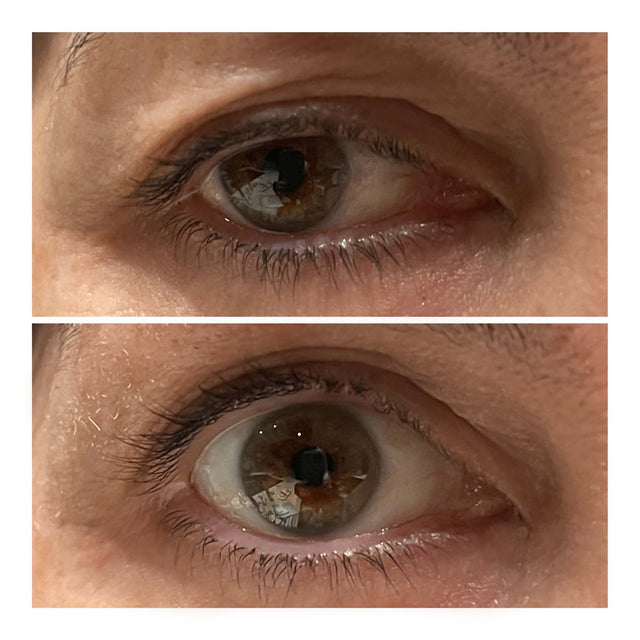 Close up of eye before after - Arlie 57 yr old female