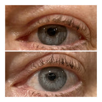 Close up of eye before after - Genevieve A. 50 yr old female
